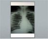 Lighted X-ray Viewer